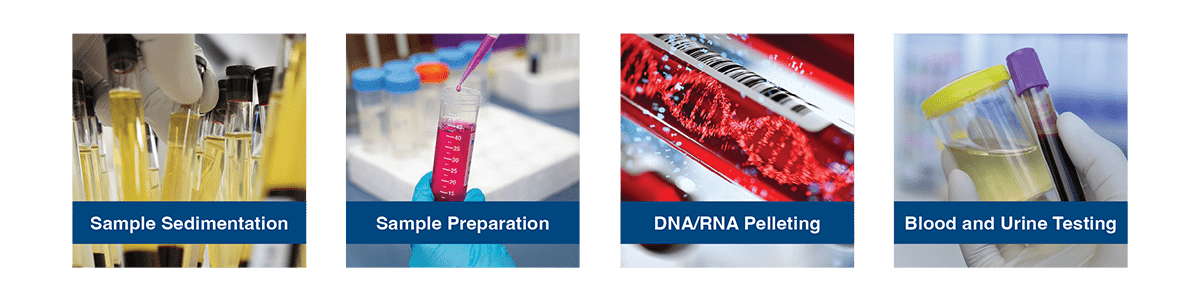 Common applications of a lab centrifuge Common applications of a lab centrifuge
